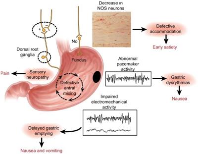 Prokinetic effect of erythromycin in the management of gastroparesis in critically ill patients—our experience and literature review